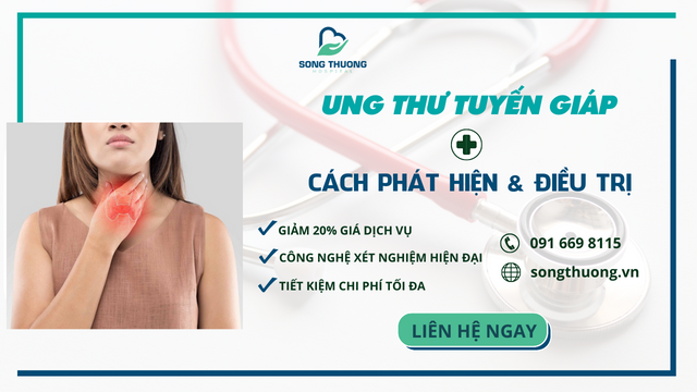 Xét Nghiệm Ung Thư Tuyến Giáp: Những Điều Cần Biết và Hướng Dẫn Chi Tiết