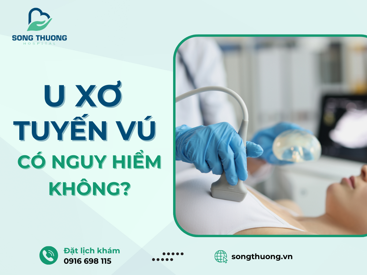 7. Các câu hỏi thường gặp về u xơ tuyến vú