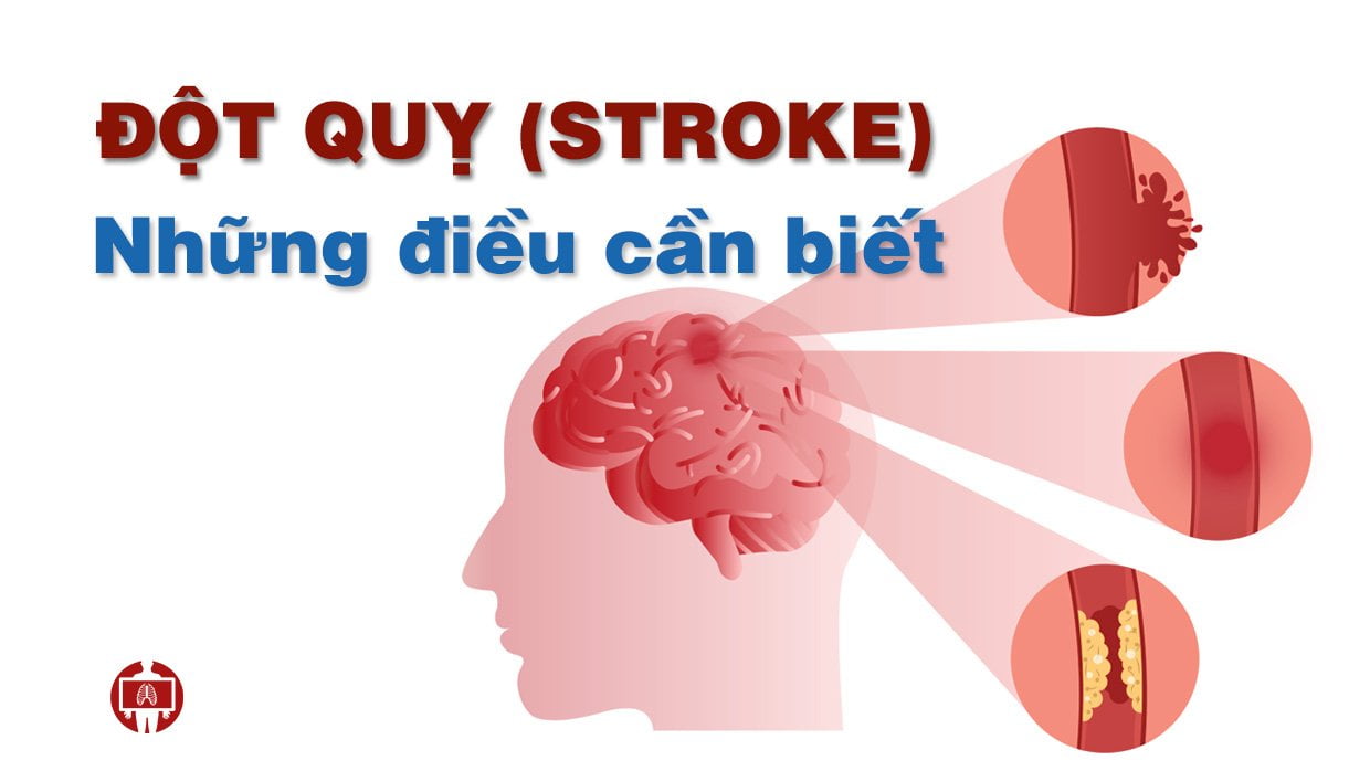 ĐỘT QUỴ NGÀY CÀNG PHỔ BIẾN - ĐỪNG CHỦ QUAN!